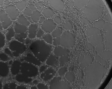 huvec tube _scr 2 frame 30 105016