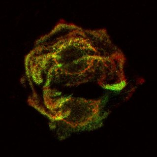 beta4-gamma2-05-extended-depth-of-focus-04-czi-rgb