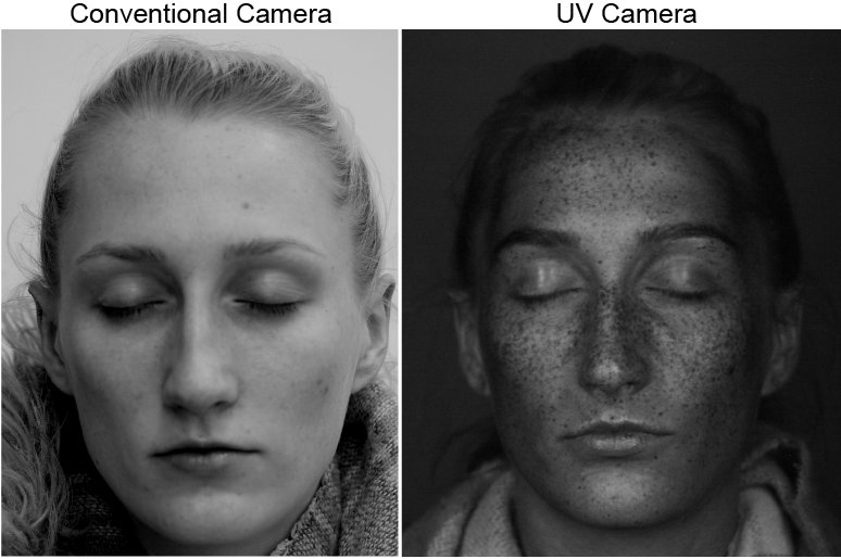UV imaging comparison