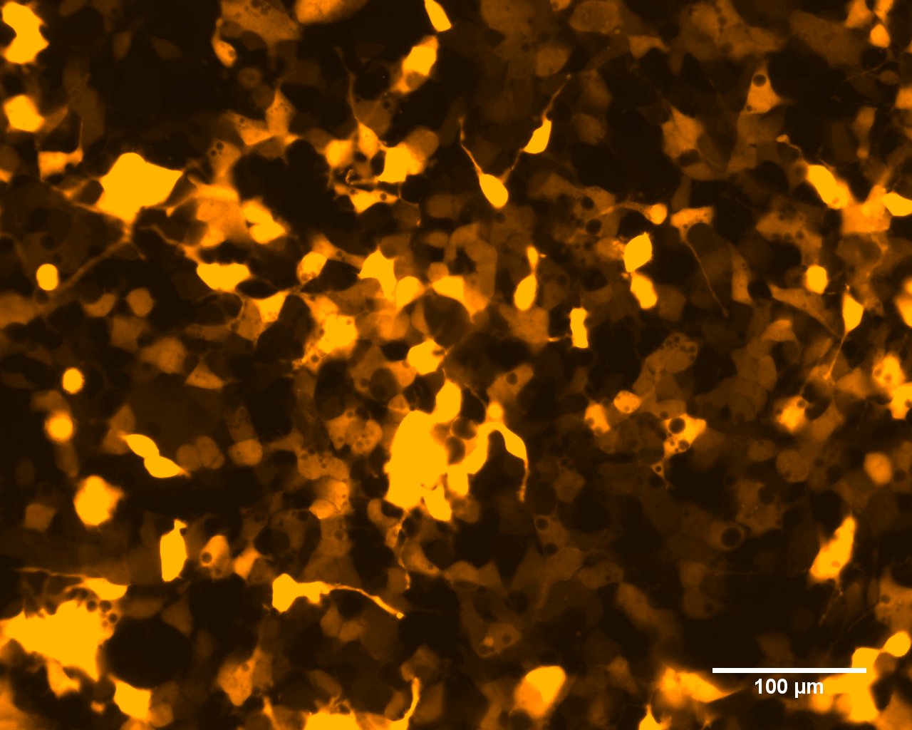 A very friendly introduction to Basement Membranes – LaNts and Laminins