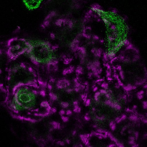 LaNt OE 24h Gb3-04.czi (RGB)