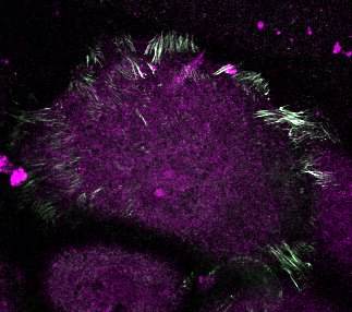 LaNtOE 24h FN G-04.czi (RGB)