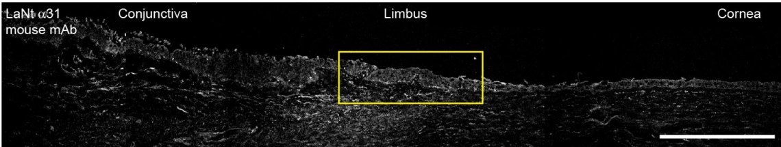 human anterior segment - LaNt