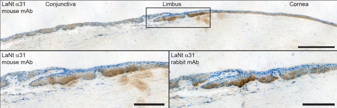 human anterior segment - LaNt HRP