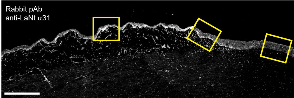 pig anterior segment - LaNt