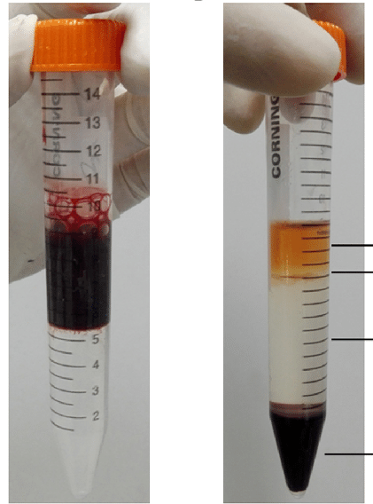 images-of-cells-collected-from-the-interface-between-the-ficoll-paque-plus-and-plasma-a